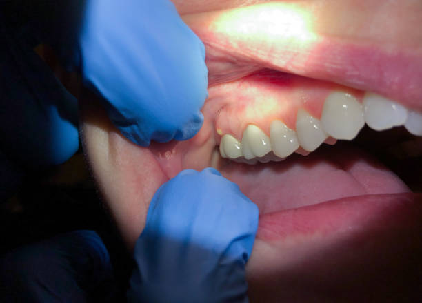 Best Walk-In Emergency Dentist in Blanchester, OH